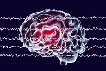 quantitative eeg